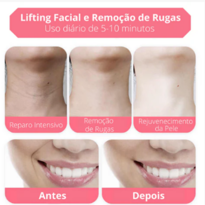 Aparelho de LED Terapia de Luz  3 em 1  Rugas Flacidez e Acne