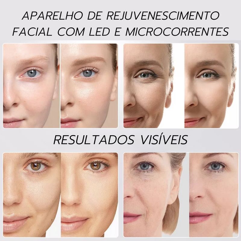 DermaTech Pro 6 em 1  –  Tratamento Facial Completo Rejuvenescimento Redução de Rugas e Linhas